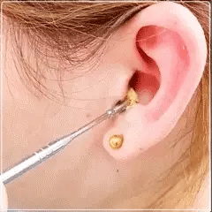 Ear Wax Removal Kit in Stainless Steel Cleaning