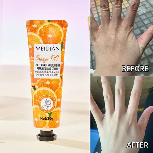 Meidian Fruit Extract Moisturizing Perfumed Hand Cream Set – Pack of 5